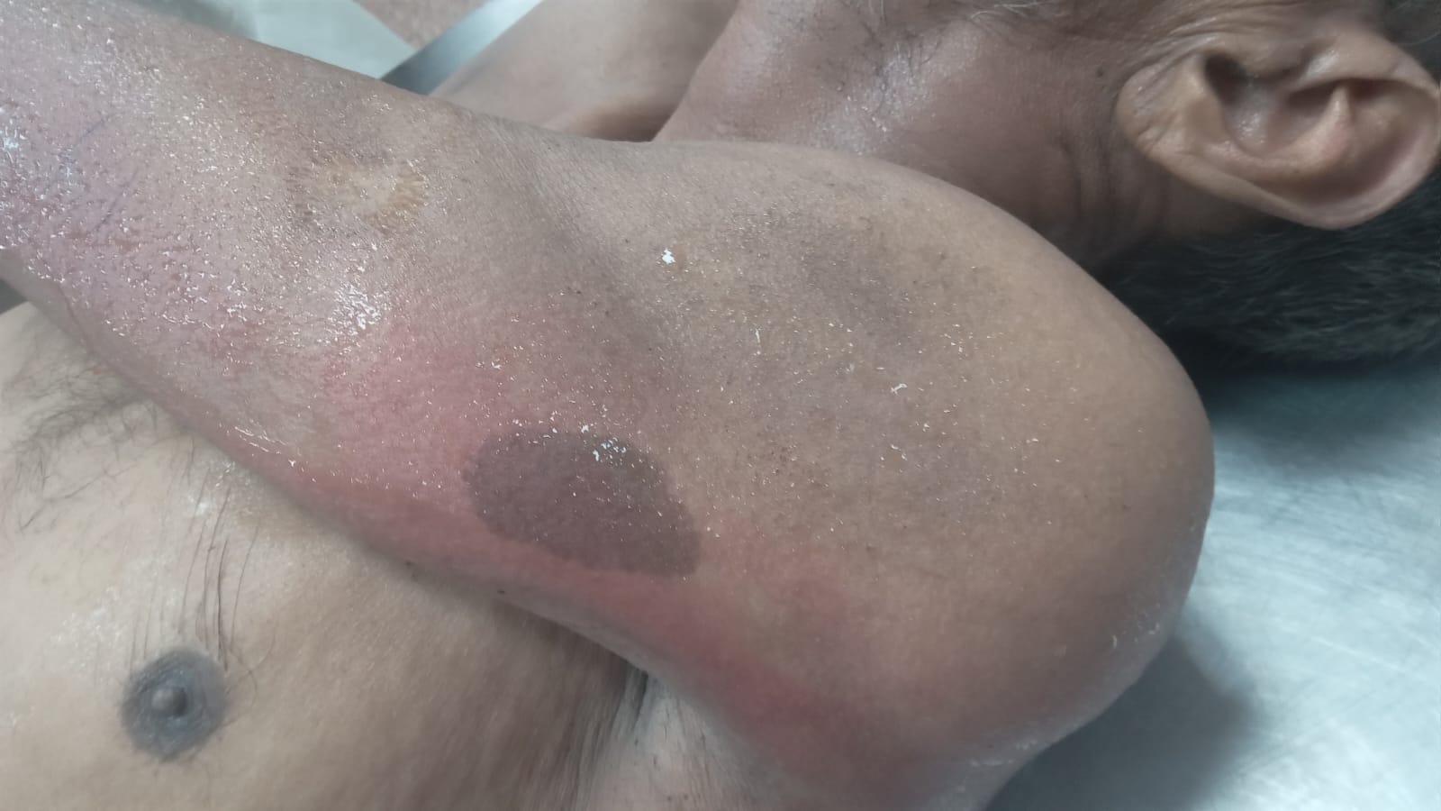 Scar Image